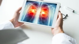 Doctors are pressing adults to have more lung cancer screenings