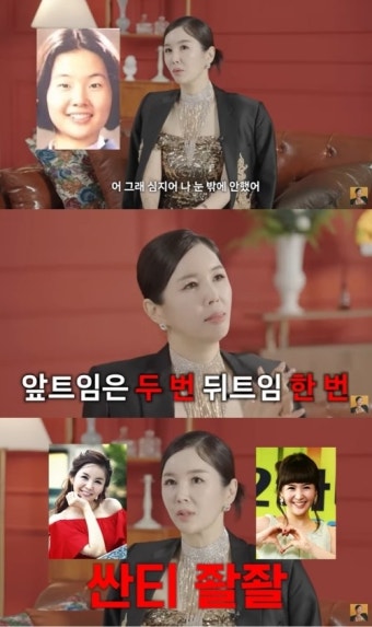 #장영란 #쌍수만 3번 눈만 성형…현재 A급 외모 :: 네이버 TV연예 #장영란 #쌍수만 3번 눈만 성형…현재 A급 외모