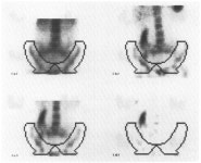 A Brief History of Medical Image Registration: Part 1 | by Kris Huang | Pymedix | Medium A Brief History of Medical Image...