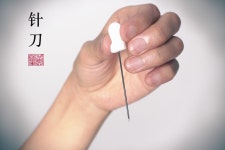 针刀: How Acupotomy Works. Acupotomy Explained | by Art of Acupuncture | Medium 针刀: How Acupotomy Works