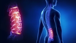 KYPHOSIS DISEASE CLASSIFICATION. Kyphosis is an abnormally excessive… | by Luca Mel | machinelearning-pyblog | Medium KYPHOSIS... 