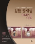 심플 골재생 (SIMPLE GBR) - 리디북스 심플 골재생 (SIMPLE GBR)