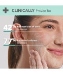 Lotus DermaBotanics Kojic Acid + Multi Berry Blemish-Free Face Wash, pH5.5, For Sensitive Skin, 100g: Buy Lotus DermaBotanics... 