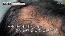 메디컬 스토리 주어진 시간