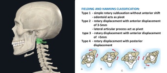 브레인포그 고치는 한의원이라는데.. - 브레인포그 마이너 갤러리