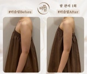 더끌림뷰티, 한국일보 주최 2023 한국 대표 브랜드 TOP100 뷰티 체형관리 부문 대상 수상 | 한국일보