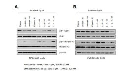 [보고서]celecoxib, 17-AAG, UCN-01의 3중복합 표적억제제를 이용한 방사선 감수성 증진 효과 - 기전연구 및 전임상시험