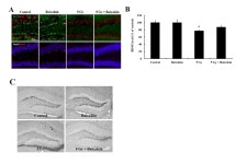 [보고서]방사선 노출에 의한 해마신경재생성 손상 제어기술개발