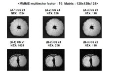 [보고서]연구용 휴먼 MRI 설치 활용사업