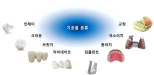 [보고서]치과기공소 내 치과보철물의 생산증대와 효율적 작업 관리를 위한 13.56MHz 주파수 대역 RFID기술을 통한 표준 생산 공정 관리... 