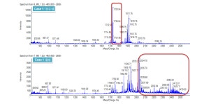 [보고서]다제내성균 감염방지능 광기능성 기관내관