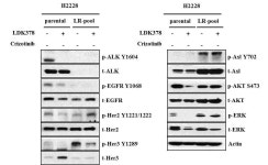 [보고서]Anaplastic Lymphoma Kinase (ALK) 양성 비소세포폐암의 ALK 저해제 내성 획득 기전 규명을 통한 내성 극복 연구