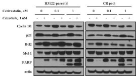 [보고서]Anaplastic Lymphoma Kinase (ALK) 양성 비소세포폐암의 ALK 저해제 내성 획득 기전 규명을 통한 내성 극복 연구