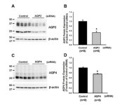 [보고서]첨단 Metabolomics 기법을 이용한 신부전 치료의 새로운 접근