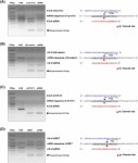 [보고서]RNAi 기반 간암 치료제 개발