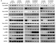 [보고서]시스템통합적 접근을 통한 차세대 폐암표적항암제 내성극복 전략개발