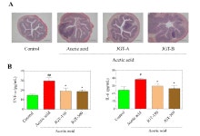 [보고서]염증성 장질환에 대한 작약감초탕의 유효성 검증 및 대사체 분석 연구