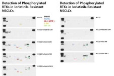 [보고서]폐암 환자유래 전임상 모델을 이용한 ALK 억제제 획득 내성 기전 연구