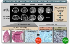 [보고서]EML4-ALK 비소세포성폐암의 면역관문억제제 효능증대를 위한 종양 내 T림프구의 대사기전연구