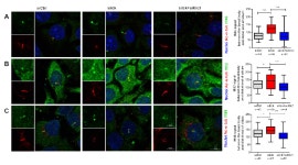 [보고서]상피세포의 항상성 조절에 관여하는 섬모의 기능 연구