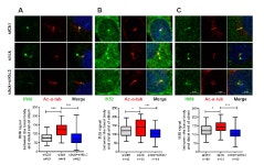 [보고서]상피세포의 항상성 조절에 관여하는 섬모의 기능 연구