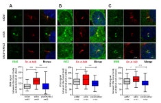 [보고서]생체신호입출력 세포소기관의 역할 규명 및 제어기술을 통한 치료기술 개발