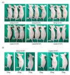 [보고서]바이오 플라즈마를 이용한 자궁경부 상피내암/초기암 비침습 치료 기술 개발