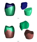 [보고서]치과 보철물 제작을 위한 CAD 시스템 개발