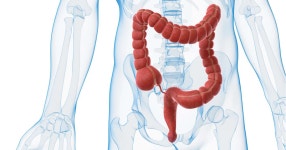 대장암 증가 현상.jpg - 글로벌 정치 미니 갤러리
