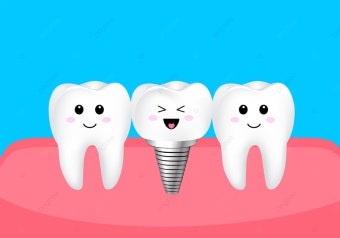 치과 임플란트와 만화 치아 캐릭터 일러스트, 캐릭터 일러스트, 만화 일러스트, 과학 기술 PNG, 일러스트 및 벡터 에 대한 무료 다운로드...