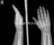 pc0040605495 | 멤버십 해외 포토