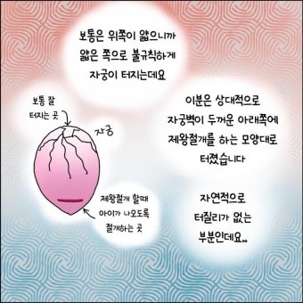 산부인과에서 출산 중 자궁이 파열되는 만화.manhwa > 만화방 | 뀨잉넷 - 온세상 모든 웹코믹이 모이는 곳 산부인과에서-출산-중-자궁이...