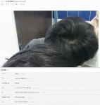 디씨 탈모 갤러리의 어그로 | 오르비 디씨 탈모 갤러리의 어그로 - 오르비