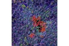A hospital germs dual strategy: How P. aeruginosa uses division of labor to colonize surfaces