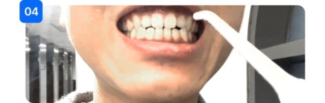 구강세정기 > 오늘의딜 특별가! 치과공식판매 구강세정기 물치실 휴대용 수압 6단계 V2 화이트 | 오늘의집 쇼핑 오늘의딜 특별가! 치과공식판... 