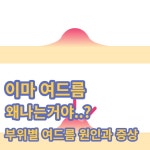 공익 하는 동안에 얼굴 여드름이라도 없애자 - 공익 갤러리