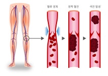희귀질환 클리닉-질환 정보 성균관대학교, 삼성창원병원, 삼성창원병원 심혈관 희귀/유전질환 클리닉, 심혈관 희귀/유전질환 클리닉, 심활관... 