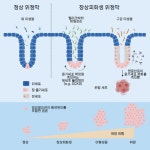 장상피화생, 위암 진행 관여 유전자 변이 규명…치료 전략 수립 활용 | 스포츠조선 장상피화생, 위암 진행 관여 유전자 변이 규명…치료 전략... 