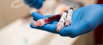 Bavarias coronavirus testing plan draws skepticism – DW – 06/28/2020