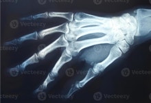 Xray of hand 3329339 Stock Photo at Vecteezy Download Xray of hand for free