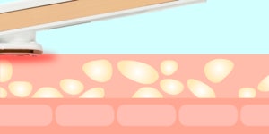 [펄케어]펄케어 고주파 음이온 양이온 EMS 뷰티 디바이스 피부관리 갈바닉 미용기기 [W CONCEPT]