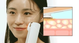 [펄케어]펄케어 고주파 음이온 양이온 EMS 뷰티 디바이스 피부관리 갈바닉 미용기기 [W CONCEPT]