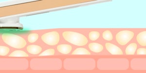 [펄케어]펄케어 고주파 음이온 양이온 EMS 뷰티 디바이스 피부관리 갈바닉 미용기기 [W CONCEPT]