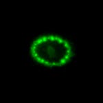 A Hubble View of Supernova 1987A | HubbleSite A Hubble View of Supernova 1987A