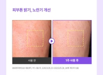 [잡티특허/임상증명] 성분에디터 머루포도 비타C 잡티앰플 30ml | 올리브영 [잡티특허/임상증명] 성분에디터 머루포도 비타C 잡티앰플 30ml