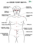 찰리정스킨독스 | 혈자리 - ▶스킨독스 - 내일을 여는사람들.. 혈자리
