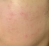 코스독스케이엠케이 | 코스독스 리액션 이야기.. - ▶피부의역설 - 내일을 여는사람들.. 코스독스 리액션 이야기..