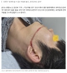워터건에 맞아 얼굴·손 다친 대학생, 안산시·축제업체 고소 - 악플달면 쩌리쩌려버려 - ＊여성시대＊ 차분한 20대들의 알흠다운 공간 워터건에... 