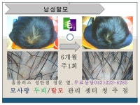 큐사랑 탈모관리전문점(고운머리) | [청주탈모][청주탈모관리] 청주탈모관리전문 모사랑 - 모사랑청주점 탈모 성공 사례 - 메이리스칼프 두피탈모관리전문센터 [청주탈모]...