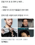 모발 이식 후 초 대박난 배우 - 악플달면 쩌리쩌려버려 - ＊여성시대＊ 차분한 20대들의 알흠다운 공간 모발 이식 후 초 대박난 배우